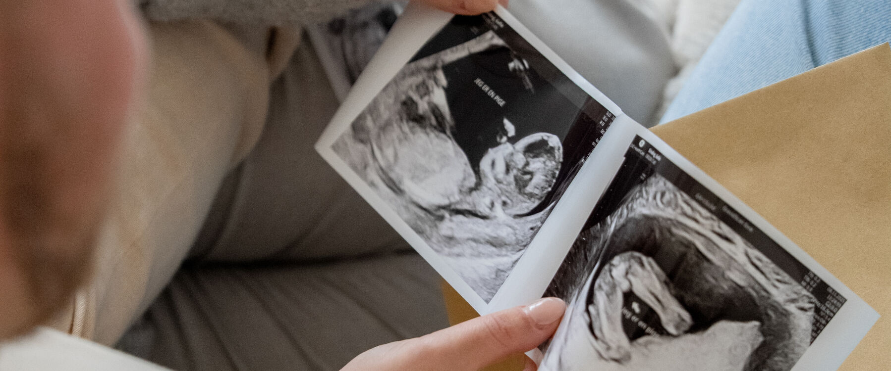 Kønsscanning hos Under mit hjerte