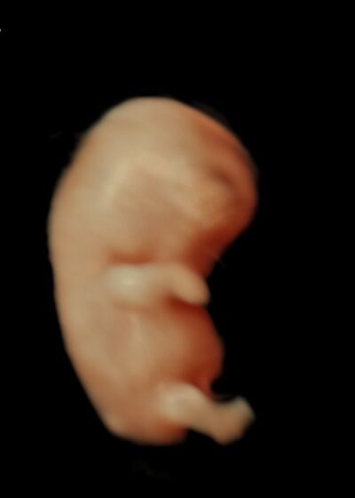 Tidlig scanning hos Under mit hjerte