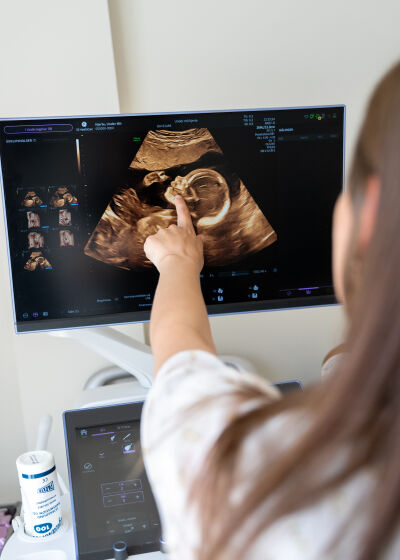 Gennemscanning hos Under mit hjerte